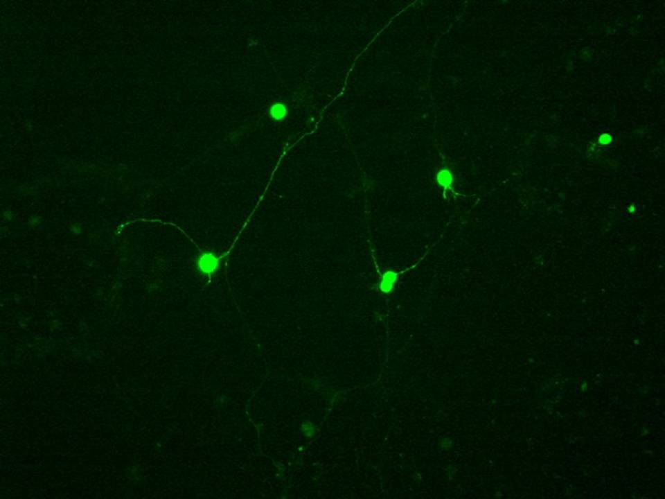 Primary Rat Neurons in Adherence - 48 hrs post EP - Transfection Efficiency 50 per cent x 2